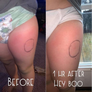 Hey Boo Natural Wound Relief - Essential Oil Blend