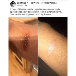 Hey Boo Natural Wound Relief - Essential Oil Blend