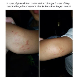 Hey Boo Natural Wound Relief - Essential Oil Blend