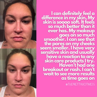 Face Lift Anti-Aging Serum - Skin Care