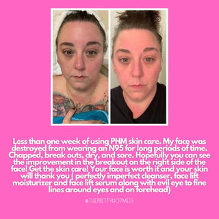 Face Lift Anti-Aging Serum - Skin Care