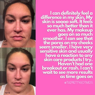 Perfectly Imperfect Exfoliating Facial Cleanser - Done