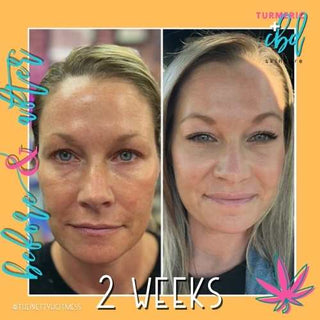 CBD + Turmeric Skin Care