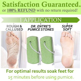 Premium Pumice Stone Set | Dr. Entre's  ✨🦶