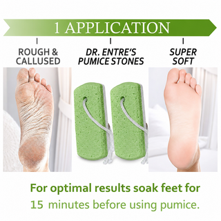 Premium Pumice Stone Set | Dr. Entre's  ✨🦶